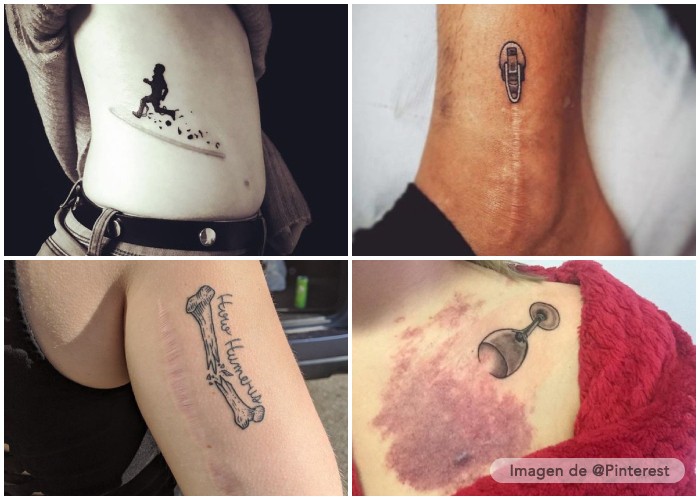 Cubriendo cicatrices con tatuajes: arte corporal sanador
