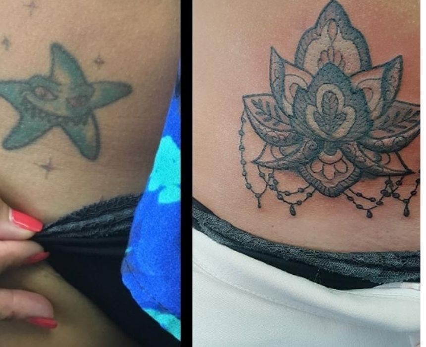 eliminar tatuajes