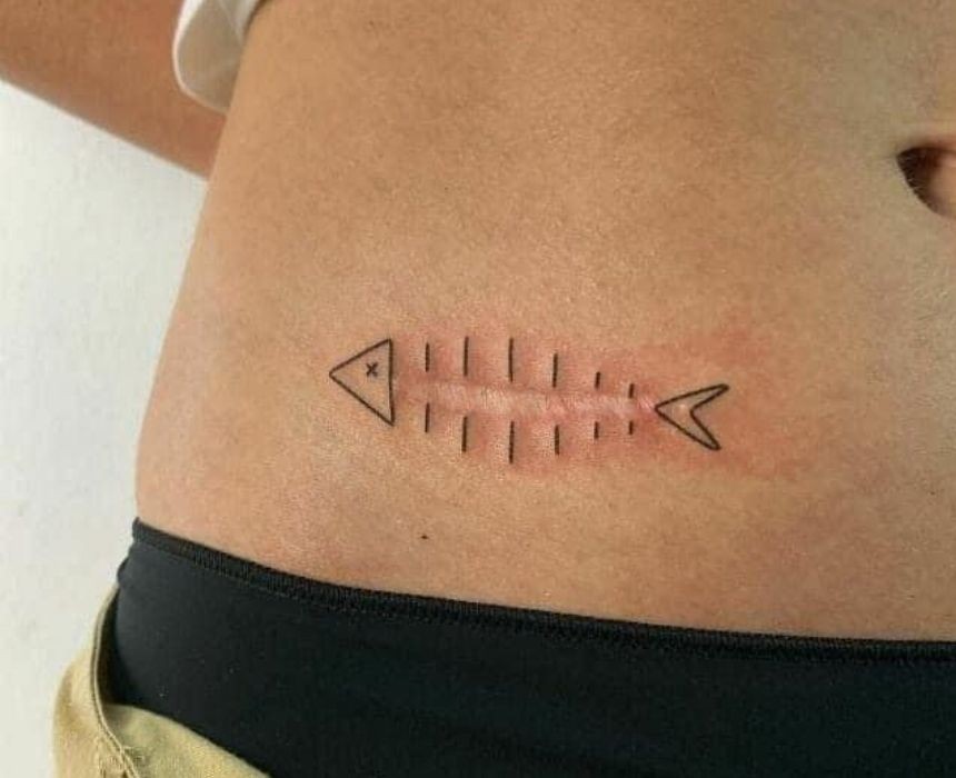 tatuaje para tapar una cicatriz